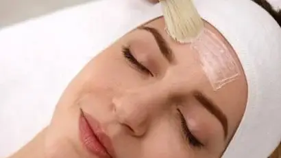 Chemical-peeling-410x309