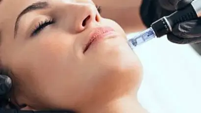 Dermapen-with-mesotherapy-410x309