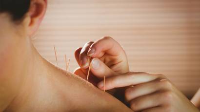 Dry Needling banner