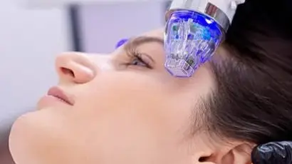 RF-microneedling-secret-410x309