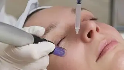 Salmon-DNA-with-microneedling-410x309